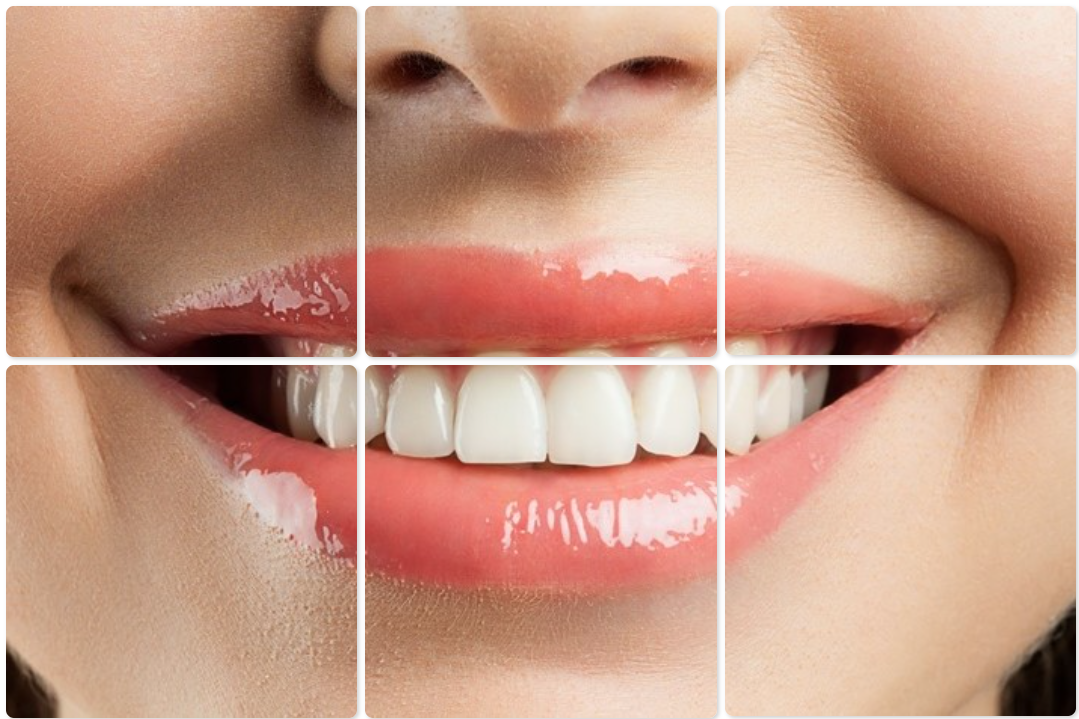 Cosmetic Dentistry