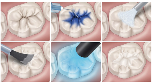 Preventive Dentistry